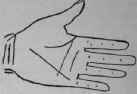 B In Combination With Other Indications 449