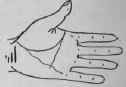 B In Combination With Other Indications 451