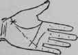 B In Combination With Other Indications 453