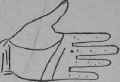 Deafness Wound In The Legs 81