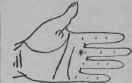 Deafness Wound In The Legs 83