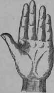 I Physical Peculiarities 226