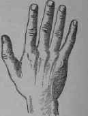 III The Useful Hand 34