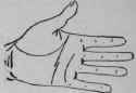 The Line Of Head VI Breaks 569