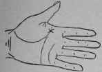 VIII Bars Capillaries And Signs 303