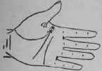 VIII Bars Capillaries And Signs 304