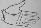 VIII Bars Capillaries And Signs 307