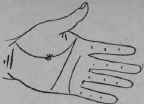 VIII Bars Capillaries And Signs 308