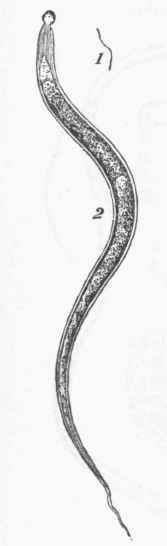 Oxyuris ver micularis (female).