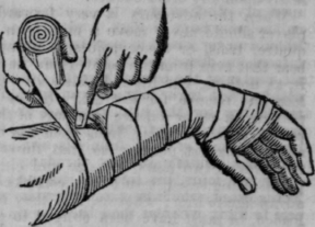 Bandages 584