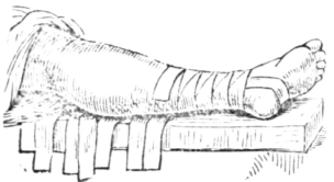 Bandages 585