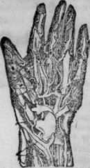 Hand 181