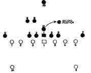 NORMAL KICK FORMATION